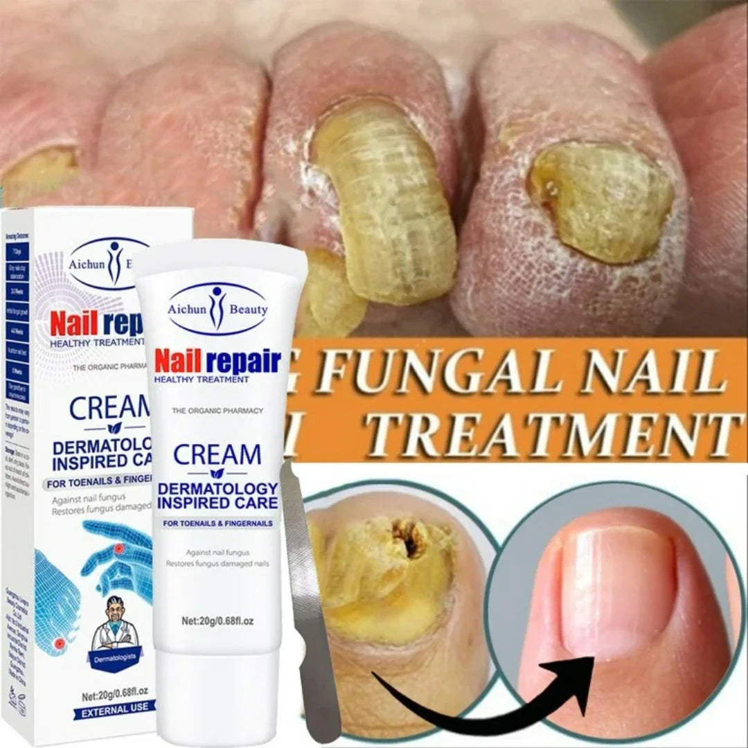 Nail repair - Anti Hongos Uñas Premium